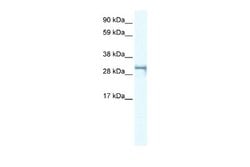 SHOX2 Antibody, Novus Biologicals 100 &mu;L; Unconjugated:Antibodies, Polyclonal